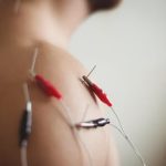 جهاز الوخز بالابر الكهربائي 3 وحدات